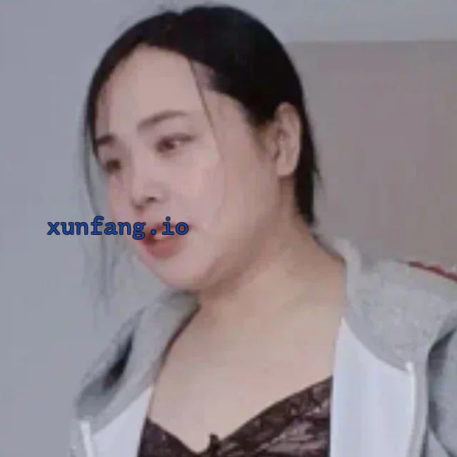 济南市 正华园小区5号楼12楼 济南张庄路森林公园泄火 实拍图 1