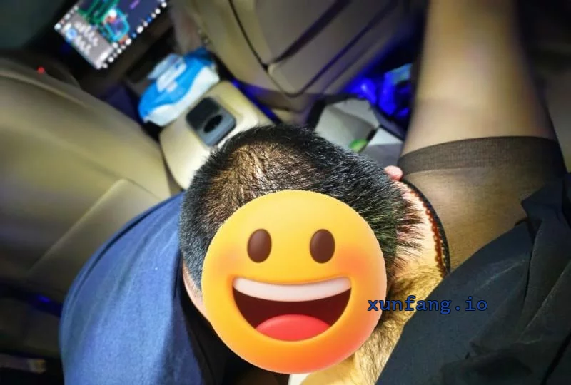 南京市 浦口区 浦口敏敏服务天花板水多毛多 实拍图 2